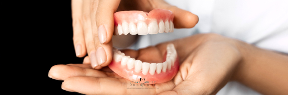 Quanto custa um implante dentário em Natal-RN? - Blog João Marcelo  Arcoverde | Leia aqui sobre implantes dentários sem cortes